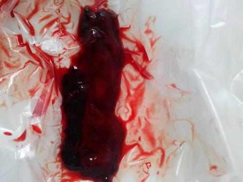 生态环境部部署防控重点湖库蓝藻水华_beat365官网(图2) beat365亚洲体育官方网站